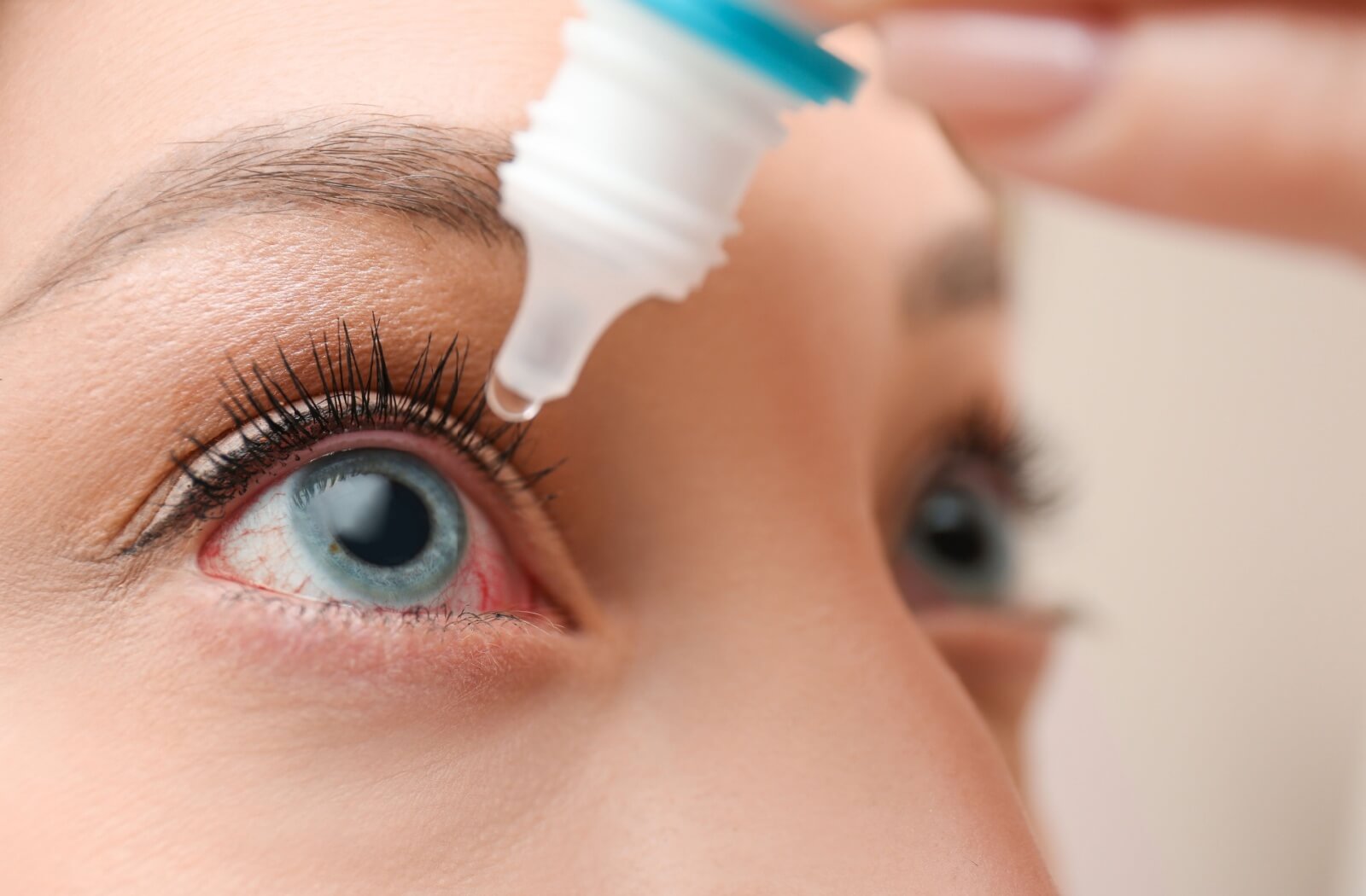 A close-up image of someone using eye drops to alleviate their dry eye symptoms.